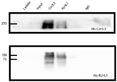 KLHL1 Controls CaV3.2 Expression in DRG Neurons and Mechanical Sensitivity to Pain